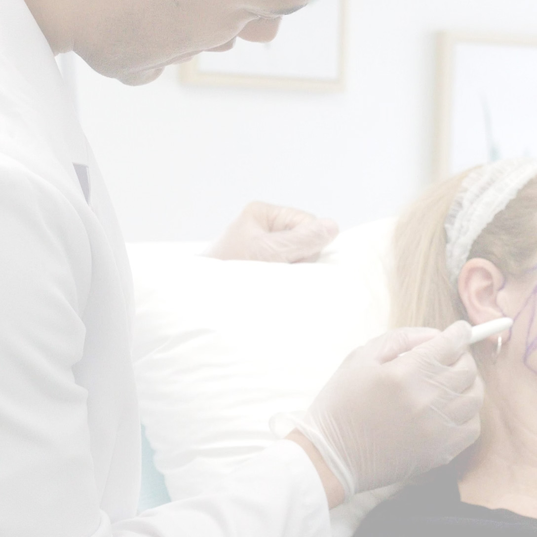 facial fat grafting